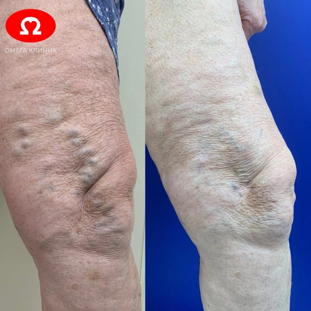 8p8uxgc9crrqmgc1dth8w052g4zful4z.jpg 8p8uxgc9crrqmgc1dth8w052g4zful4z.jpg